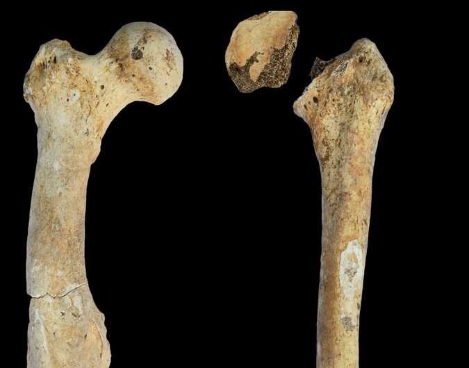Right and left femoral bones of a male individual from the North Caucasus.