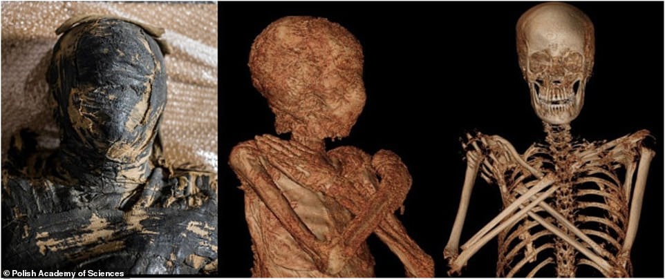 World's First Pregnant Ancient Egyptian Mummy 