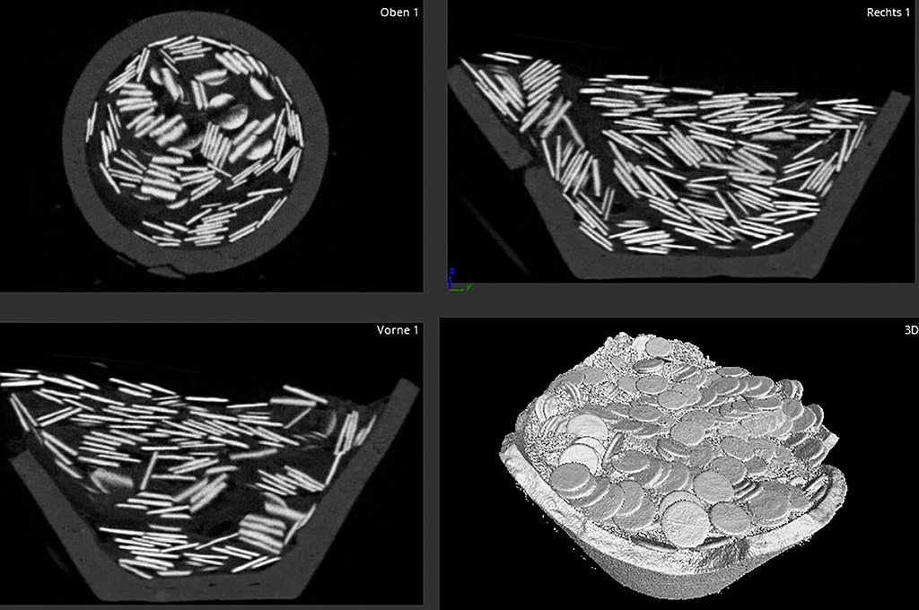 A black space seen in the CT scans between two layers of coins turned out to be a simple piece of leather.