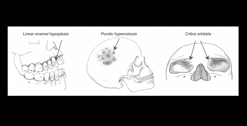 Drawings of skeletal indicators of nonspecific stress evaluated in the study. Credit: Katharine Thompson