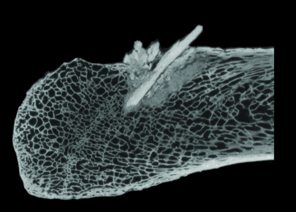 Ct scan of bone point fragments embedded in the rib. Photo:  Center for the Study of the First Americans, Texas A&M University