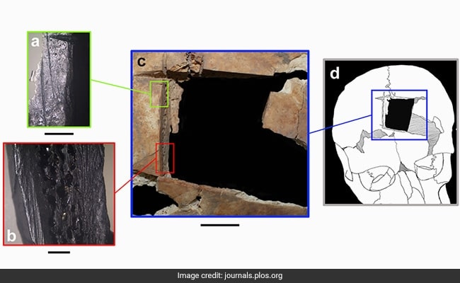 The remains of two brothers were found in a Bronze Age tomb in the city of Tel Megiddo, Israel. Photo: Journal Plos