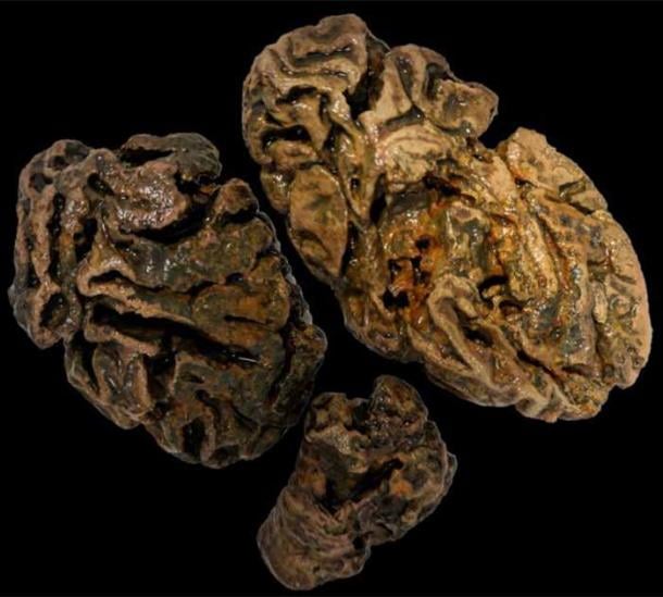 Fragments of a brain from an individual buried in a waterlogged Victorian workhouse cemetery (UK), some 200 years ago were the only soft tissue not totally dissolved. Photo: Alexandra L. Morton-Hayward/Royal Society Publishing