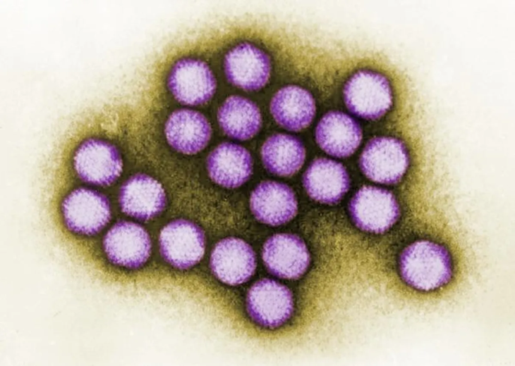 Adenovirus is one of three viruses isolated from Neanderthal remains. Image credit: CDC/ Dr. G. William Gary, Jr. / Public Domain