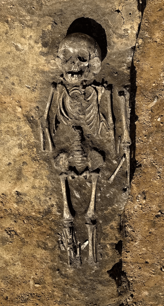 Grave of a child with ‘hydrocephalus’ from Wettin-Löbejün. Photo: Oliver Dietrich / State Office for Heritage Management and Archaeology Saxony-Anhalt