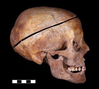 The skull of the individually buried woman, was sawn into pieces to remove the brain, right side view. © M. Bessou/CNRS UMR