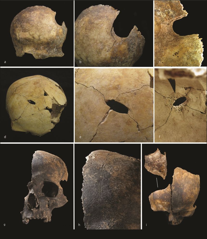 Examples of skulls from the assemblage, with evidence for blunt force trauma and cut marks. Credit: Schulting et al. Antiquity, 2024.