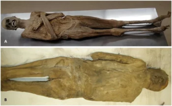 The mummy's external appearance from the front (A) and back (B) showed no incisions on the body. Credit: Andreas Nerlich
