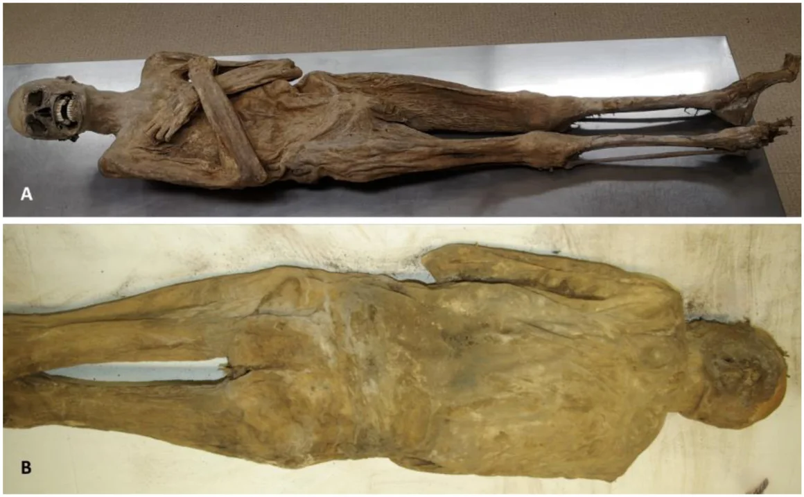 The mummy's external appearance from the front (A) and back (B) showed no incisions on the body. Credit: Andreas Nerlich