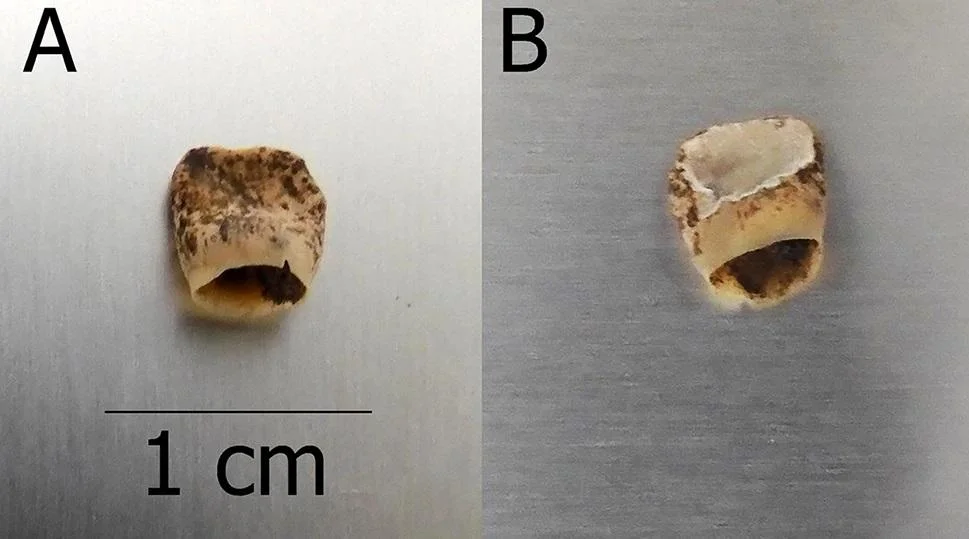 Tooth before (A) and after (B) sampling for ancient DNA analysis. Credit: Poulain et al., Archaeol Anthropol Sci (2025)