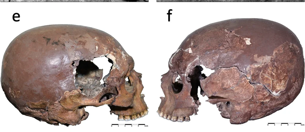 Lateral (left and right) view of the AC12 cranium as it is currently preserved in the Museum of Anthropology in Florence. Credit: T. Mori et al. Scientific Reports (2025)