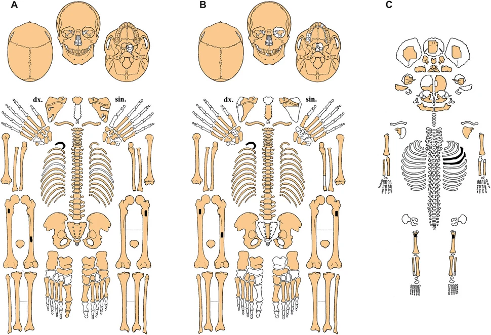 Preservation scheme, skeleton H1 (A), H2a (B), H2b (C) (drawing by I. Jarošová and M. Fojtová). Source: Vaníčková et al., 2025, Archaeological and Anthropological Sciences, Vol. 17, Article 146. DOI: 10.1007/s12520-025-02251-1)