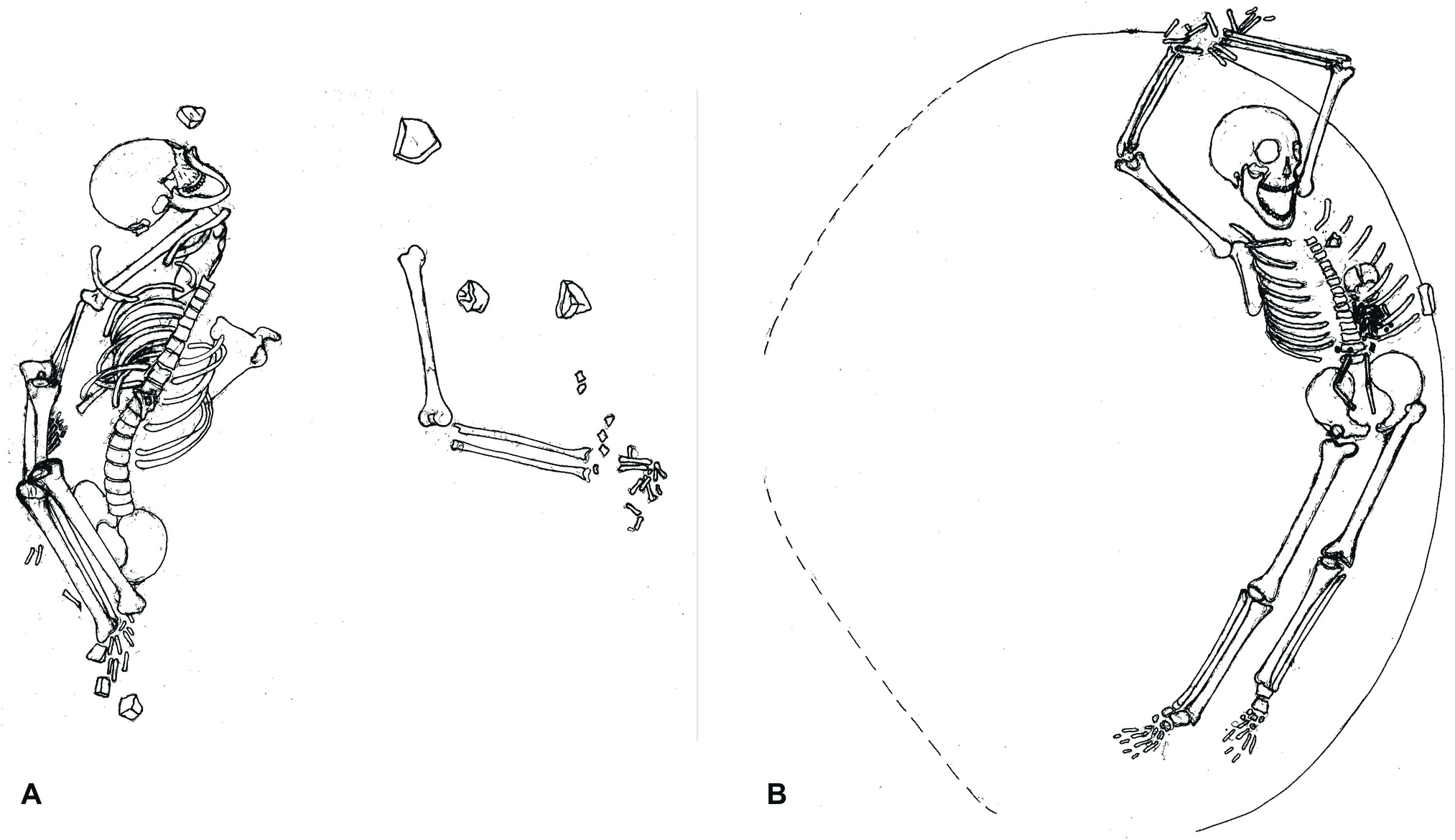 Ritual burials discovered deep within a prehistoric mining shaft in the Krumlov Forest, Czechia. The remains of two related Neolithic women and a newborn—believed to have been buried as part of symbolic or sacrificial practices—offer unique insights into female labor and life 6,000 years ago.” Source: Vaníčková et al., 2025, Archaeological and Anthropological Sciences, Vol. 17, Article 146. DOI: 10.1007/s12520-025-02251-1)