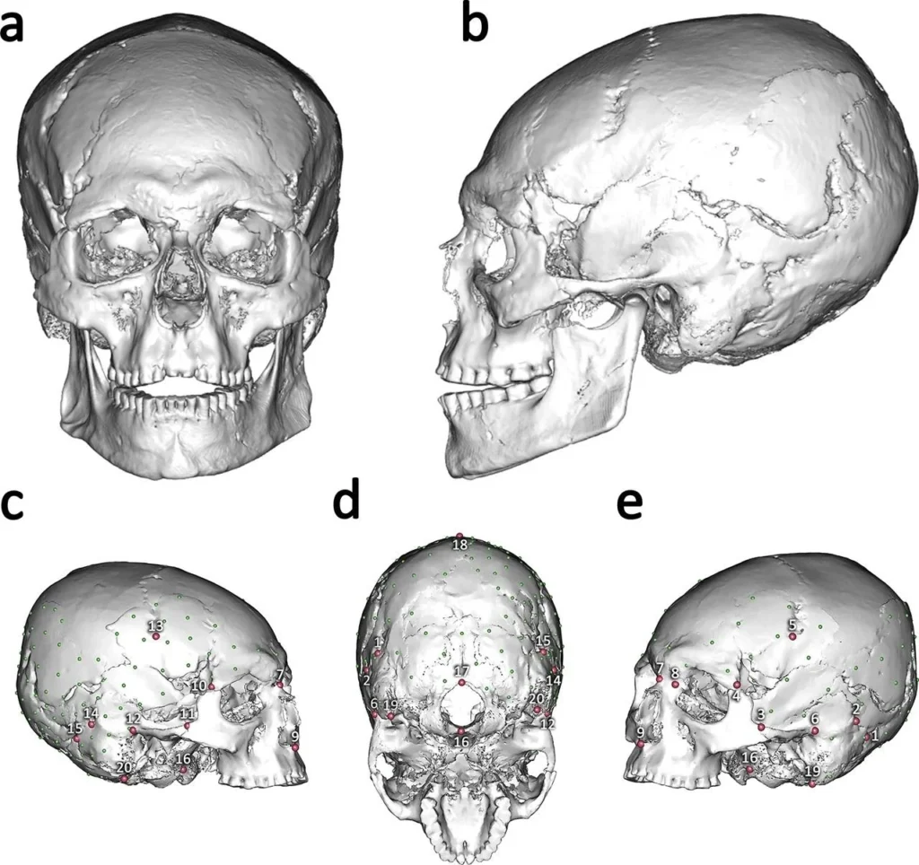 Virtual reconstruction of AC12 V1 with landmarks and semilandmarks. (a,b) frontal and left lateral views of full reconstruction of AC12 V1; (c–e) anterior oblique and inferior views of AC12 V1 showing landmarks (red dots, numbered as listed in Supplementary Table 4) and semilandmarks (small green dots). Credit: T. Mori et al. Scientific Reports (2025)