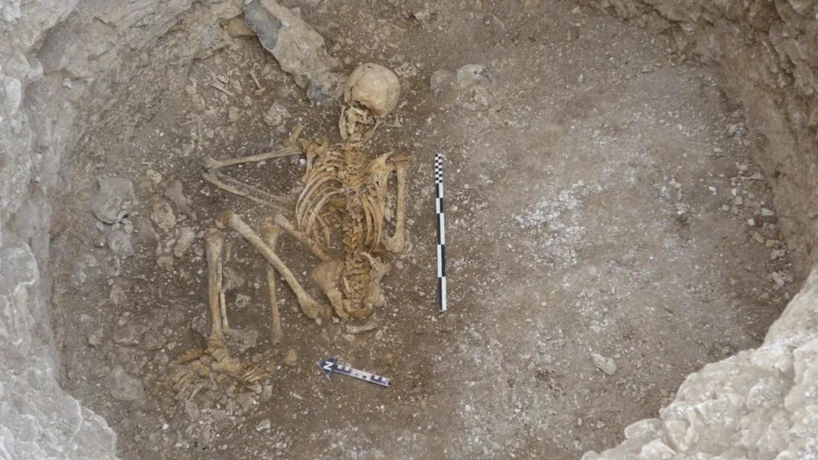 A 2,000-year-old Celtic teenager may have been sacrificed and considered “disposable.” Credit: Bournemouth University