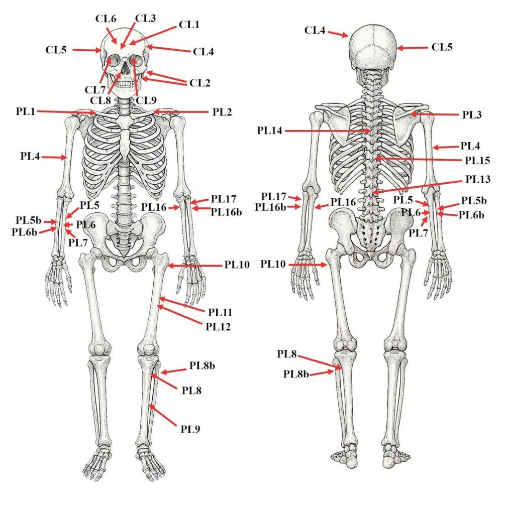 The observed perimortem lesions on the human remains (CL=cranial lesion, PL= Postcranial lesion). The drawing of the skeleton was generated using OpenAI’s image generation tools (DALL·E) via ChatGPT. Credit: Eötvös Loránd University (ELTE)