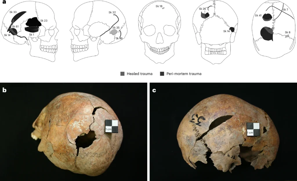 
a–c, Distribution and examples of cranial injuries recorded at Gomolava (a), including Sk26 in posterior-lateral view (b) and Sk33 in right-lateral view (c); both individuals had sustained extensive peri-mortem injuries. In both cases, the primary impact site is clearly recognizable as a void with missing bone, with secondary fractures radiating from the impact site (drawings by S.N.). Credit: Fibiger, L. (2026), Nat Hum Behav 