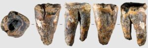 59,000-Year-Old Neanderthal Tooth May Be the Earliest Evidence of Dental Treatment