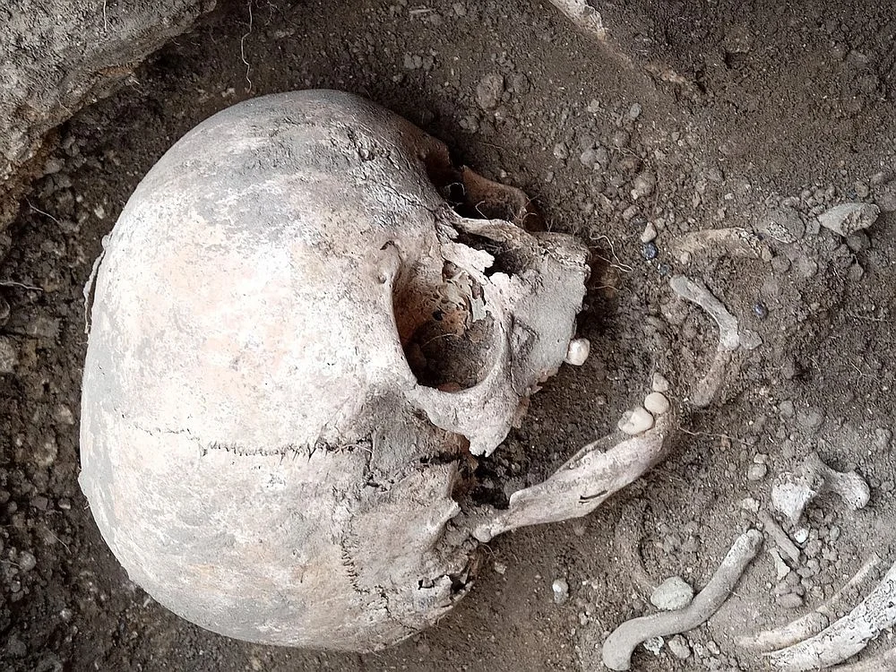 Based on the shape of the skull, researchers suspect the child may have had hydrocephalus. Credit: Artesian Archaeological Expedition (AAE) via VK