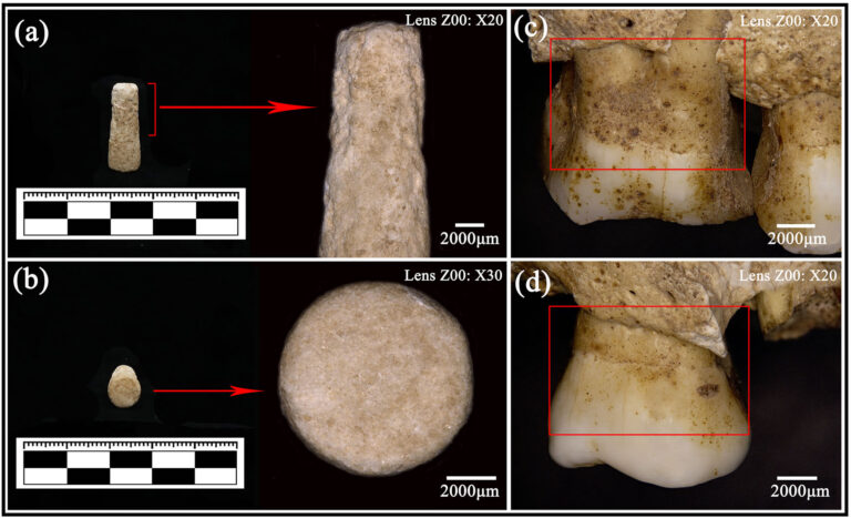 Microscopic views of the cylindrical stone object and adjacent teeth from Burial M280. Credit: Wang et al., npj Heritage Science (2026), CC BY-NC-ND 4.0.