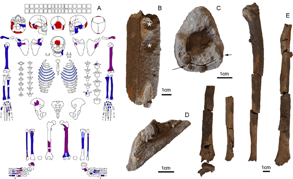 Bone preservation and damage in a young woman buried at Göbeklitepe.