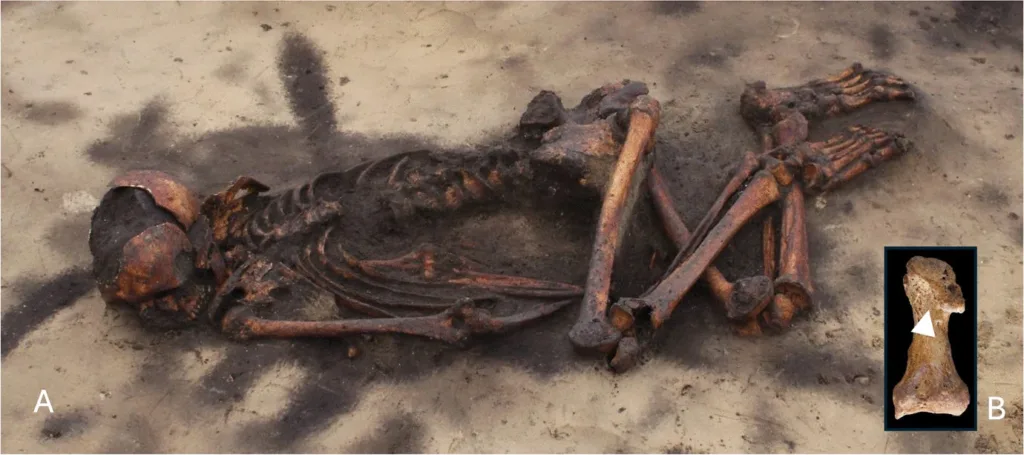 In situ remains of a 25–35-year-old man from Iron Age Denmark alongside close-up views of fractures and sharp-force trauma.