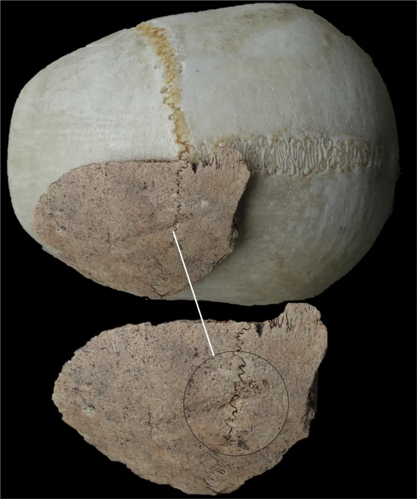 Partial human cranium from Uppåkra showing a healed sharp-force injury near the frontal and parietal bones.